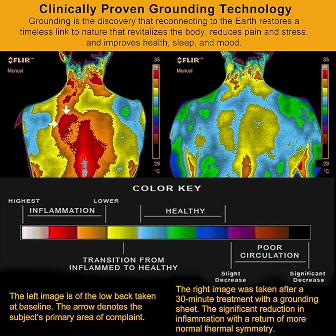 Earthing Fitted Bed Sheet(King/Queen)