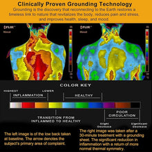 Load image into Gallery viewer, Earthing Fitted Bed Sheet(King/Queen)